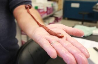 This Worm Was Chilling in a Lab for Years. Turns Out It’s a Record-Breaker