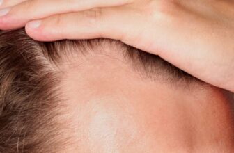 New Baldness Drug Boosted Hair Growth by 539% in Trials